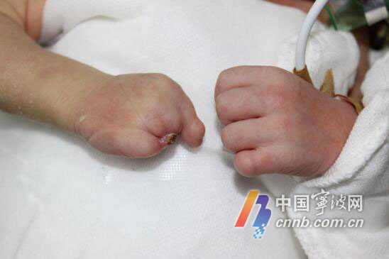 哈尔滨借卵流程 哈尔滨试管婴儿排行哪些医院比较好？ ‘孕10周b超可以看男女